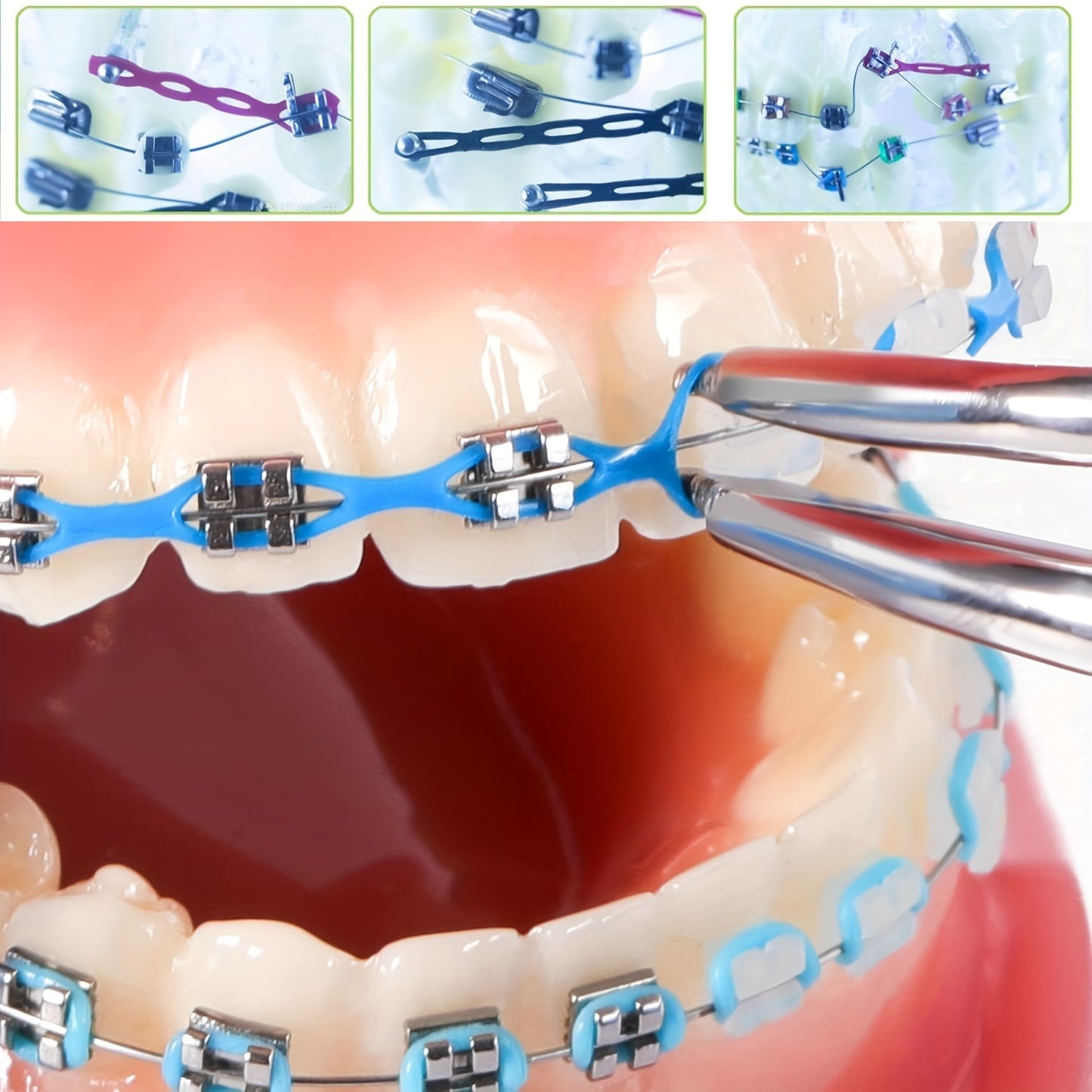 Oral Care
Ultra-Flex Orthodontic Elastic Chain - Durable Rubber Bands For Braces, Easy Application & Long-Lasting, Transparent & Color Options Braces Rubber Bands