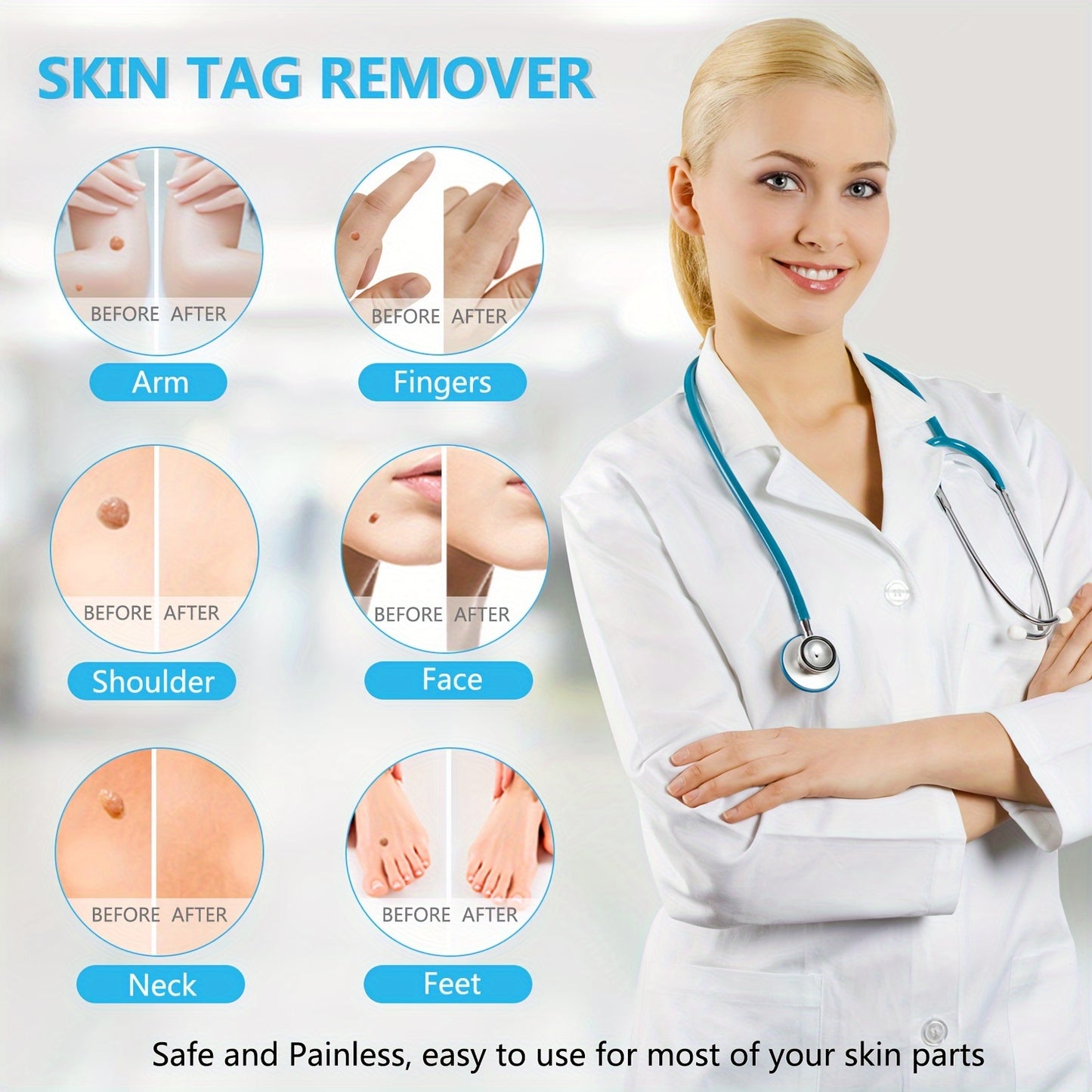 Beauty Tools
Auto Skin Tag Removal Tool Kit, 3 in 1 Skin Tag Remover Device, 1mm to 8mm Auto Wart Remover, Safe & Painless & Easy Remover Clear Skin Tag & Mole at Home